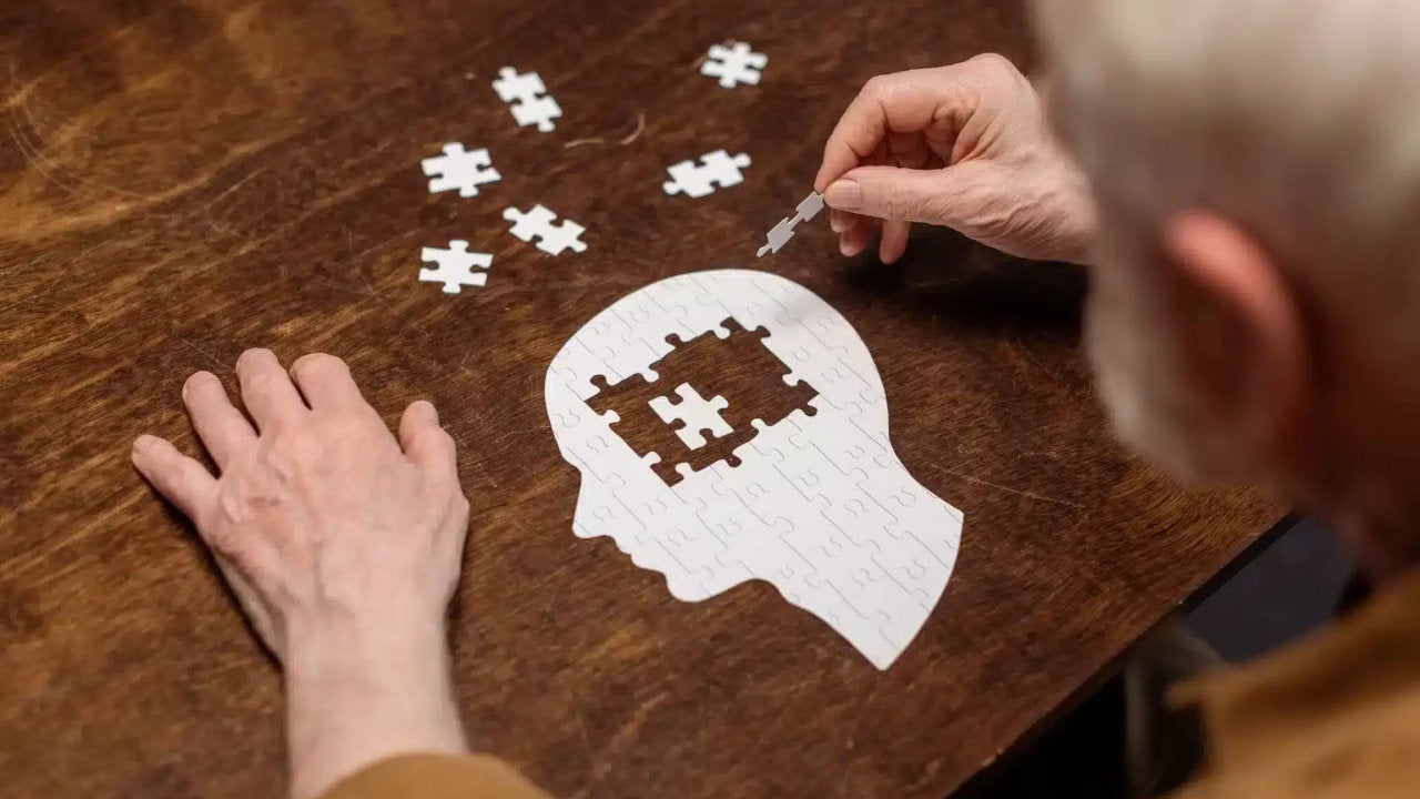 El Alzheimer no tiene cura