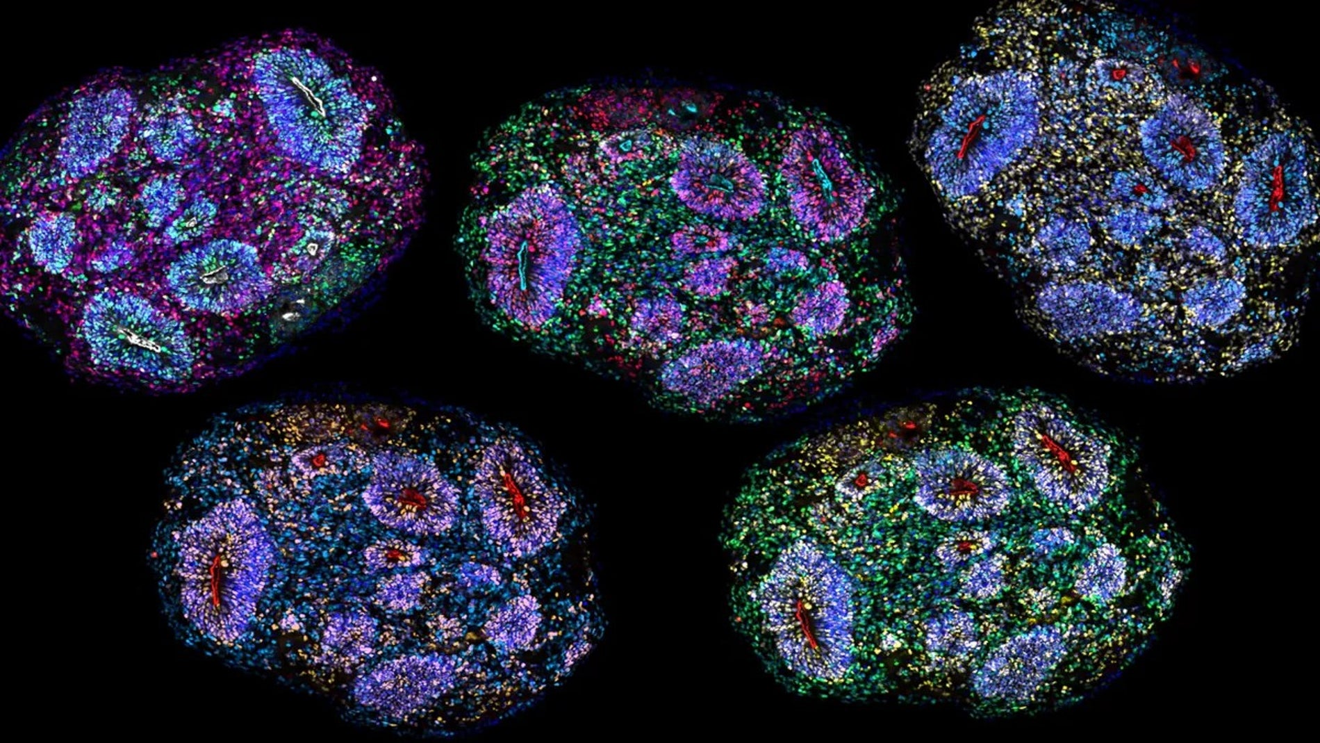 Unos minicerebros humanos sobreviven casi seis años en el laboratorio superando el récord de dos años anterior y muestran señales de envejecimiento