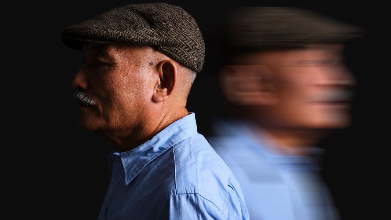 La enfermedad de Alzheimer es la forma más común de demencia, representando hasta el 80 % de los casos