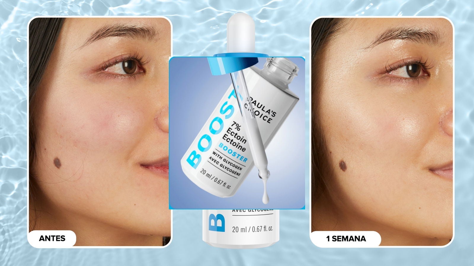 Booster 7 % Ectoína | Tras una semana de uso