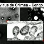 Virus Crimea Congo