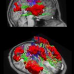Un nuevo atlas para el cerebro