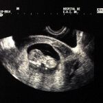Acerca de la conciencia: la objeción de conciencia