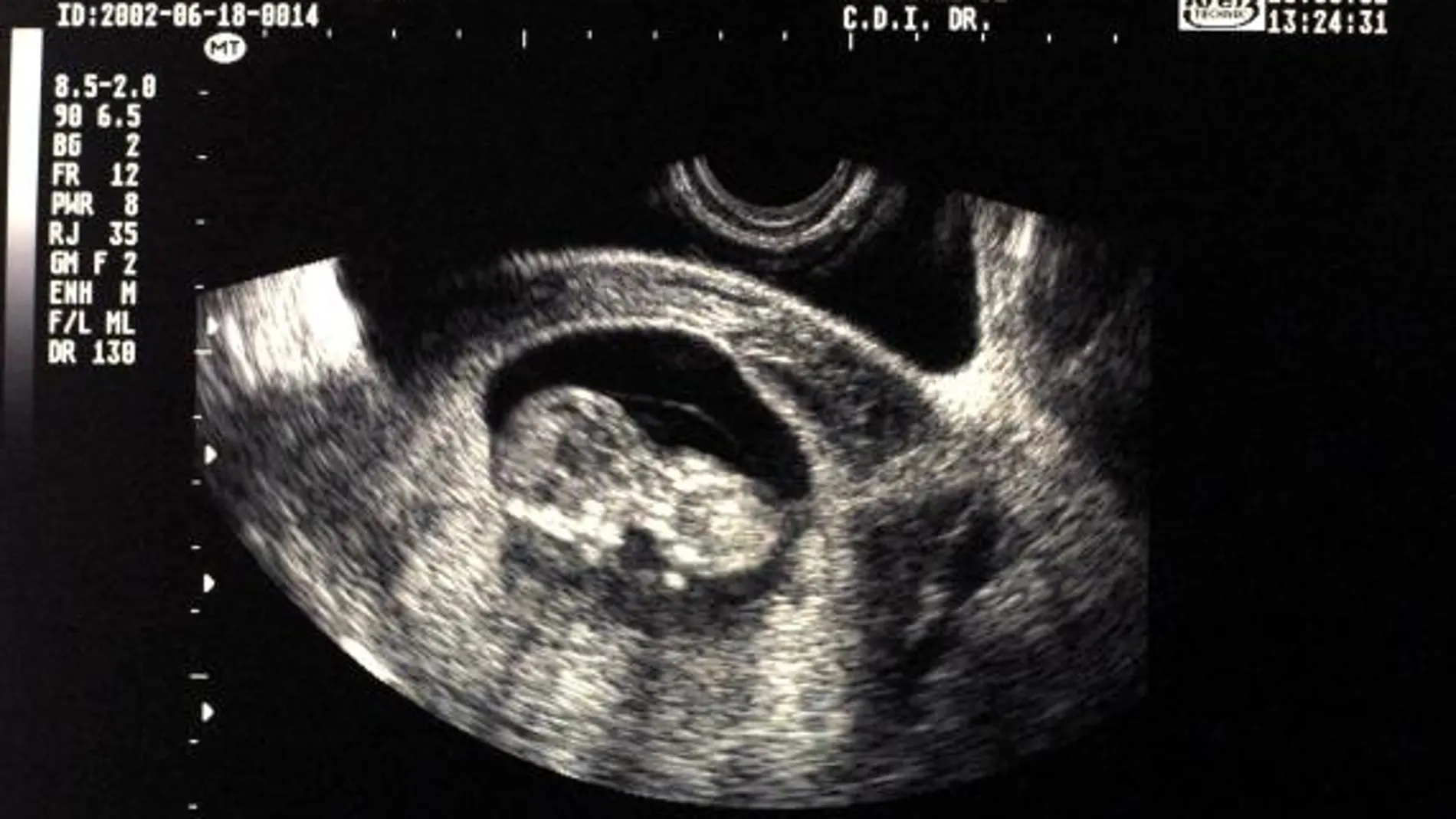 Acerca de la conciencia: la objeción de conciencia