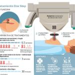 Radioterapia intraoperatoria, aliada del cáncer de mama