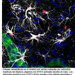 Células metastásicas en el cerebro (en verde) rodeadas por astrocitos reactivos (en blanco), algunos con STAT3 activo (núcleo en rojo). CNIO
