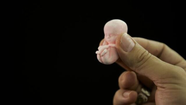 Una de cada tres mujeres que abortan ya lo ha hecho antes