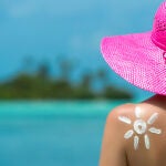 5 tips para tratar las quemaduras solares
