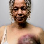 Elizabeth Salazar, de 63 años, fue diagnosticada con cáncer de mama hace ocho meses. Foto: Amnistía Internacional.