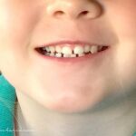 Los dientes de leche: más bocadillos y menos bollos