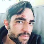 ¿Qué le ha pasado en la cara a Dani Mateo?