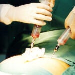 Cien nuevos donantes de médula al día en España