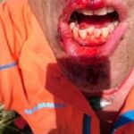 Impactantes imágenes del accidente de Jesús Calleja