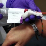 No todas las mujeres con cáncer de mama inician el tratamiento de quimioterapia que se les recomienda