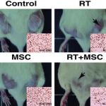 La imagen muestra cuatro animales con dos tumores cada uno. Las fotografías son representativas del crecimiento de los tumores en los grupos control (sin tratar), tratados solo con radioterapia (RT), tratados con células mesenquimales (MSC) y tratados con la combinación de células mesenquimales y radioterapia (RT+MSC). Las flechas indican los tumores que han recibido el tratamiento con radioterapia, el tumor contralateral no tratado es representativo del efecto de vecindad.