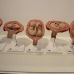 La venta de tejido fetal activa el debate sobre el aborto en EEUU