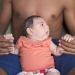Un bebé nacido con microcefalia es sostenido por su padre, en Brasil