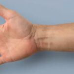 El sensor da la alerta frente a indicios de cáncer de la próstata, del pulmón, del colon y de mama