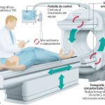 Diagnóstico más rápido, preciso y con menor radiación