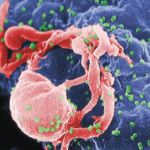 Se cumplen 35 años del primer informe oficial sobre el Sida