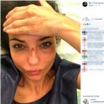 Mari Cielo Pajares, sufre un grave accidente