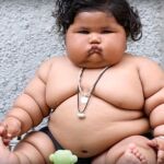 El bebé de ocho meses, Chahat Kumar, ya pesa 17 kilos