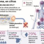 Una estrategia más agresiva logra curar el mieloma múltiple