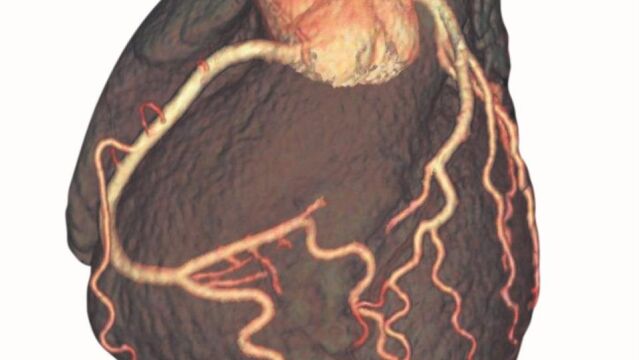Practicar ejercicio físico regular cambia el corazón