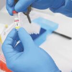 En agosto se empezarán a realizar las primeras pruebas en humanos