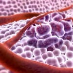 Tecnología 3D contra el cáncer