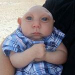 Jaxon, el niño con medio cerebro que conmueve en las redes sociales