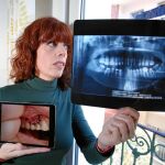 María José muestra una radiografía y la imagen de una de sus encías. Ha pasado hasta cuatro veces por quirófano. Debe usar un aparato y sufrirá las secuelas de por vida