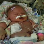 La pequeña intubada en el hospital antes de morir.