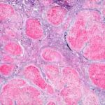 Virus de la hepatitis C