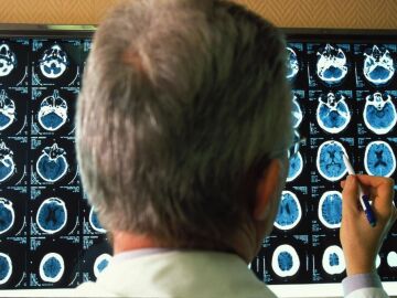 Un investigador analiza radiograf&iacute;as de cerebros con Alzheimer