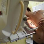 Una mujer se somete a una mamografía para prevenir el cáncer de mama