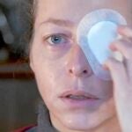 Quintana defiende que perdió el ojo por un impacto de un proyectil de goma