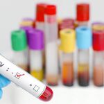 Los científicos de Chicago han examinado varias secuencias víricas extraídas de células de los nódulos linfáticos y de la sangre de tres pacientes