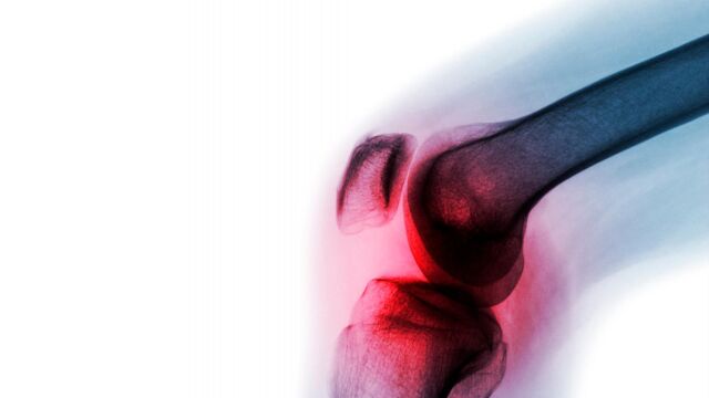 El 30% de las consultas atendidas en Atención Primaria son motivadas por problemas osteoarticulares / Foto: Dreamstime