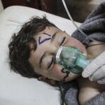 Un niño recibe tratamiento médico tras el ataque químico contra la localidad de Jan Shijún