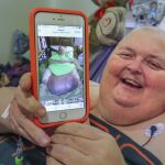 El paciente, Roger Logan, muestra su tumor tras la operación