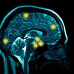 Un escáner del cerebro, en una imagen de archivo
