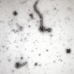 El equipo de investigadores del Albert Einstein College en Nueva York partió del estudio de la sangre de un superviviente del brote de 2014