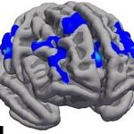 Dime cómo es tu cerebro y te diré cómo eres