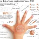 La nueva terapia para la urticaria reduce un 58% sus síntomas