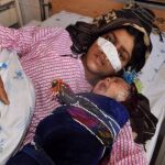  Un afgano le rebana la nariz a su esposa