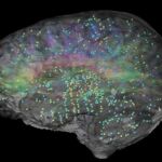 Atlas del cerebro