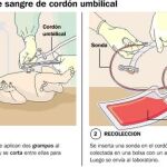 El almacenamiento de células madre extraídas del cordón umbilical: nociones básicas.