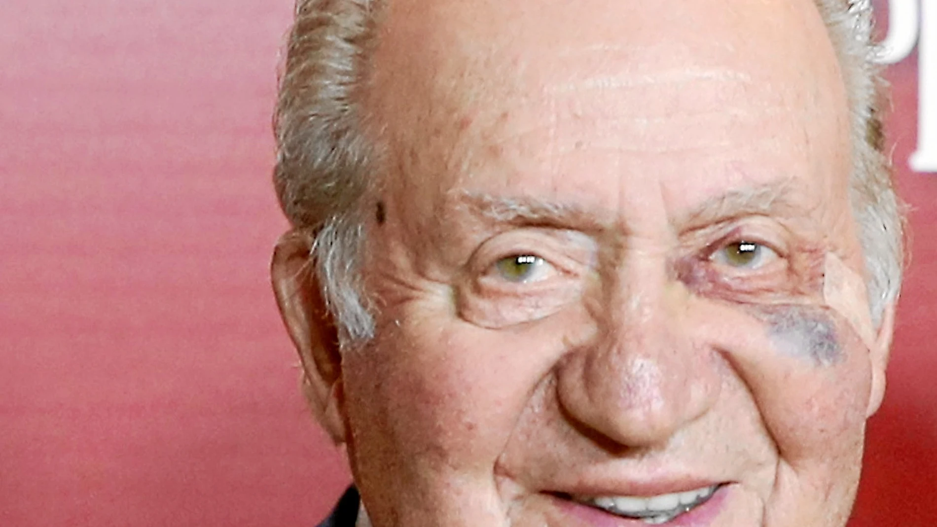 Las heridas de guerra de Don Juan Carlos