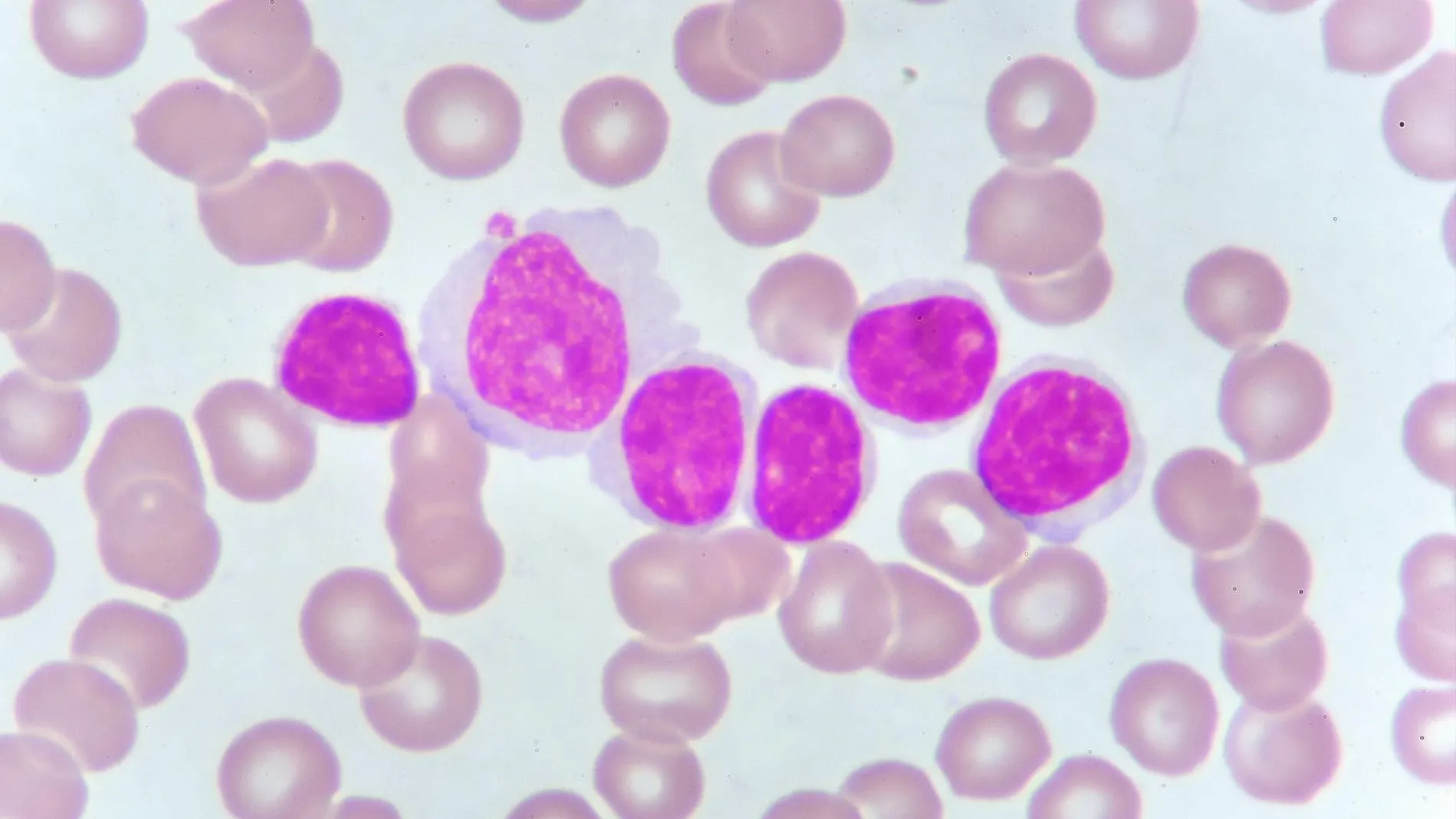 Genoma de la leucemia / Foto: Dreamstime